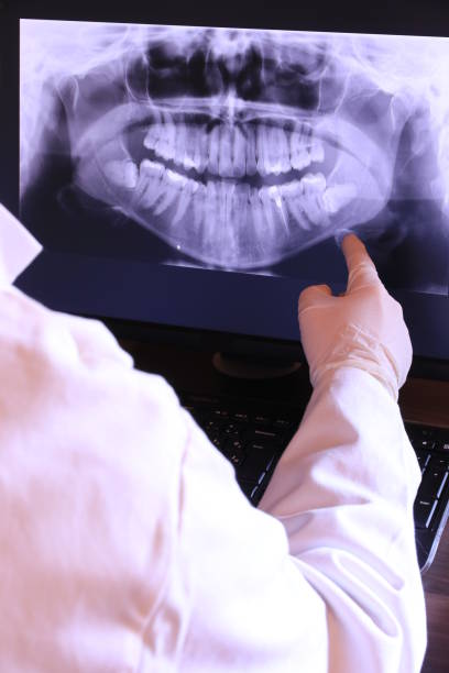 Best Emergency Treatment for Dental Infections or Abscesses in Montrose, MI