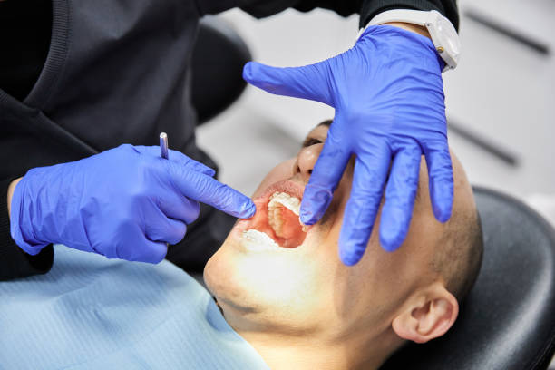 Best Emergency Tooth Extraction in Montrose, MI